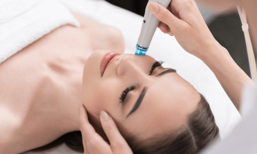 Microneedling Therapy for Collagen Stimulation – How it Works?
