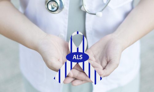 Amyotrophic Lateral Sclerosis Symptoms – Stem Cell Therapy Benefits and Risks for ALS